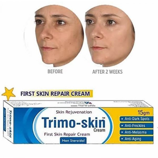 trimo skin acne cream review